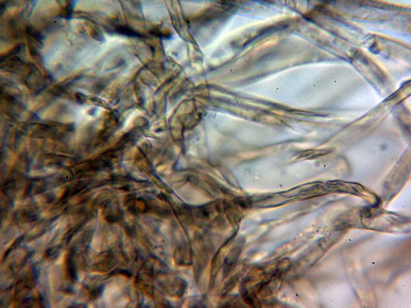 Microscopía de Inocybe melanopus - 11 - Cutícula agua 1